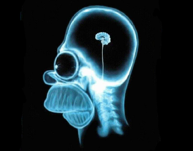 20130315 Brain