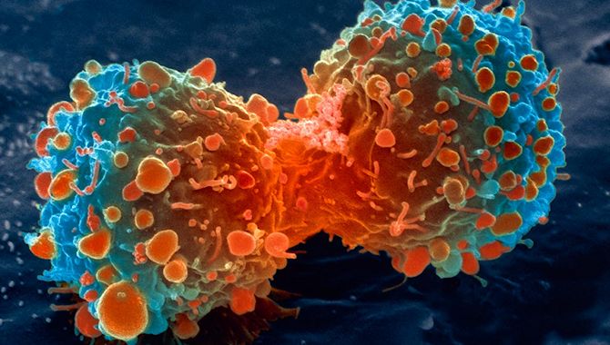 Cancer often occurs coincidentally' - Vox magazine