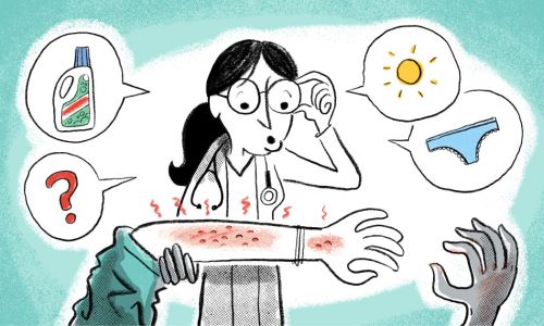 Illustratie: Roel Venderbosch