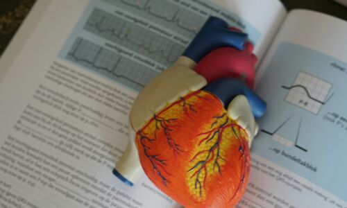 Hartinfarct studies